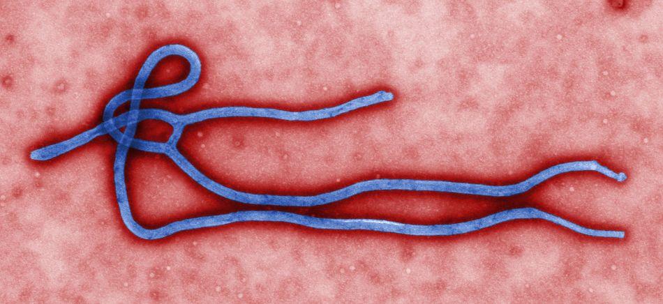 A preview of the Ebola virus.
